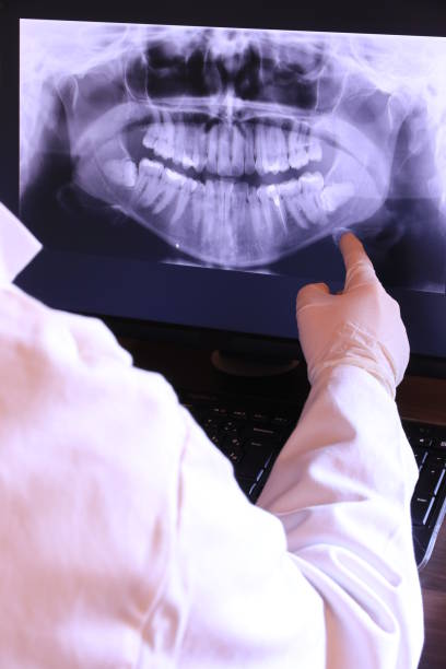 Best Emergency Wisdom Teeth Removal in Vley, AL
