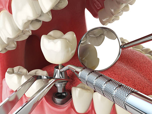 Best Walk-In Emergency Dentist in Vley, AL